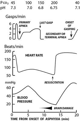 A Global View of Neonatal Asphyxia and Resuscitation